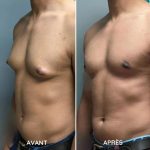 Débardeur de Compression Amincissant et Respirant - Occamarket