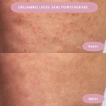 Épilateur Électrique Sans Douleur 2-en-1 - Occamarket