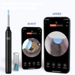 Ottonet™ | Nettoyeur d’oreilles intelligent 360° avec caméra HD - Occamarket