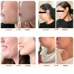 Gaine visage anti-double menton | Facelift™ - Occamarket