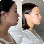 Gaine visage anti-double menton | Facelift™ - Occamarket