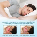 Gouttières Anti Ronflement et Anti Bruxisme - Occamarket