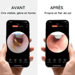 Nettoyeur d'oreille intelligent avec caméra - Occamarket