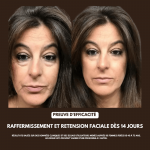 GlowSkin - Brosse Drainage Lymphatique - Occamarket