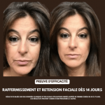 GlowSkin - Brosse Drainage Lymphatique - Occamarket