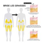 Bracelet ultrasonique brûleur de graisses pour perte de poids - Occamarket