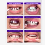 SOIELYSSE™ | Bandes Blanchissantes Violettes Sans Peroxyde (14 Bandes) - Occamarket