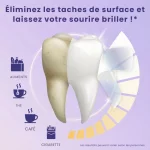 SOIELYSSE™ | Bandes Blanchissantes Violettes Sans Peroxyde (14 Bandes) - Occamarket