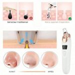 Aspirateur de points noirs - Nettoyage profond des pores - Occamarket