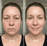 LymphBrush™ - Brosse Drainage Lymphatique Coréenne - Occamarket