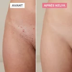 DERMIA - Rasoir Femme Anti douleurs - Occamarket